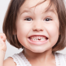 Pentru parinti: Ce facem cand incisivii copilului incep sa iasa stramb