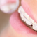 Cum ingrijim aparatul dentar fix? Medicul stomatolog ne explica!
