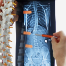 3 progrese în tratamentul scoliozei care pot rezolva cazuri considerate fără soluție 