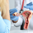 Tot ce trebuie să știi despre legarea trompelor uterine de la un medic ginecolog