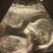 In Saptamana Patimilor: Noua Lege a Avortului