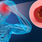 Ceea ce ne protejează inima, ne protejează și creierul. Accidentul vascular cerebral - Cum îl prevenim și cum îl tratăm