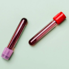 Eritrocite crescute la adulti sau copii – ce inseamna