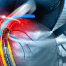 Cum pot fi tratate bolile grave de inimă fără operație pe cord deschis?