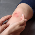 Cum să gestionezi rănile minore. Sfaturi pentru o vindecare rapidă