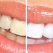 Cele mai eficiente metode prin care putem avea dinți albi și strălucitori