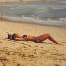 Solutii de vara simple si rapide: cum sa tratam arsurile provocate de soare