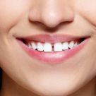 Strungareata - de ce apare si cum o putem trata