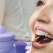 Explicațiile medicului ortodont: Este indicat să aplicăm aparatul dentar în perioada vacanței?