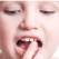 Interviu cu Dr. Oana Laslau: importanța purtării aparatului dentar la adulți și copii