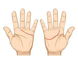 Linia din stanga e mai sus decat cea din dreapta. 