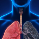 Expert pneumolog: in fumul de tigara exista substante radioactive