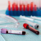 Trombocite scazute la adulti sau copii – ce inseamna