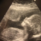 Curiozitati, intrebari si lamuriri: Lichidul Amniotic