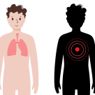 O tumoră giant, unică în istoria medicinii la un copil de 10 ani, a fost operată cu succes în Istanbul 