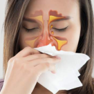 Sinuzita îți dă bătăi de cap? Câteva remedii homeopate care te pot ajuta să o tratezi 