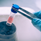 Cele mai frecvente afecțiuni în care celulele stem sunt eficiente