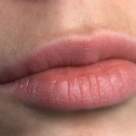 Ce trebuie sa stii despre Herpesul la copii