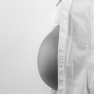  Expunerea la soare in timpul sarcinii benefica sau nu?