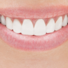 5 trucuri de expert pentru un zambet sanatos si stralucitor 