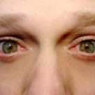 In pielea tenului se citeste starea de sanatate a organismului 