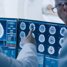 Radioterapia performantă - tratamentul oncologic care poate învinge cancerul 