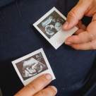 Infectiile cordonului ombilical – cauze si tratament