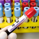 Hormonul foliculostimulant (FSH) – ce rol are si cand se testeaza?