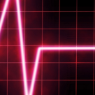 Peste 50% dintre femei decedeaza din cauza bolilor cardiovasculare