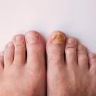 10 semne că picioarele tale au nevoie de mai multă atenție