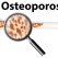 Osteoporoza, boala tăcută a cifrelor mari în România