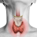 Semne si simptome care pot indica probleme ale glandei tiroide