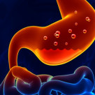 Cancerul gastric: Top 4 factori de risc 