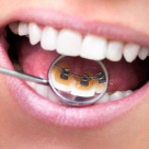 Expertul ne invata: Cum sa alegem aparatul dentar potrivit noua