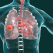 Campanie pentru depistarea precoce a cancerului bronhopulmonar: 50 de bronhoscopii gratuite efectuate lunar