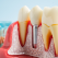 Implanturile dentare: cât de mult a evoluat tehnologia și de ce digitalizarea scurtează timpul de tratament