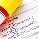 Top analize recomandate dacă vreți să slăbiți sănătos. 'Trebuie să investigăm mai întâi funcția tiroidiană!'