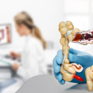 Dr. Victor Tomulescu: ”Screeningul identifică cancerul colorectal înainte ca o persoană să aibă simptomatologie”