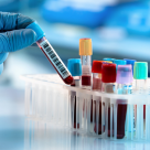 Hormonul anti-Mullerian – cand se testeaza si ce rol are?