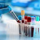 Hormonul anti-Mullerian – cand se testeaza si ce rol are?