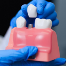 Implantul dentar: Pași de urmat pentru o procedură reușită 