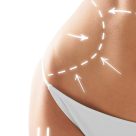 3 retete ca sa scapi de celulita!