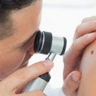 Cum iti dai seama daca alunitele tale sunt cancerigene