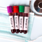 Grupa de sânge care te face mai vulnerabil la AVC. Ce poți face pentru a preveni