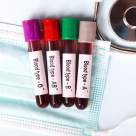 Grupa de sânge care te face mai vulnerabil la AVC. Ce poți face pentru a preveni