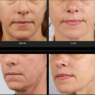 Congresului National de Dermatologie aduce un nou produs pentru frumusetea pielii