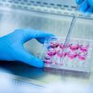 Analiză: Celulele stem, speranță pentru pacienții cu Alzheimer și sindrom Down