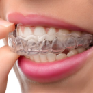 Aparatul dentar mobil - cum se poarta si cum il ingrijim