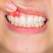 Gingii inflamate și dureroase. Ce trebuie să știi despre gingivită?